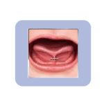 Benefits of tongue tie release