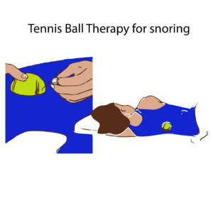 Tennis Ball Therapy